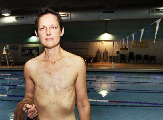 Breast Cancer Survivor Wins Fight to Swim Topless